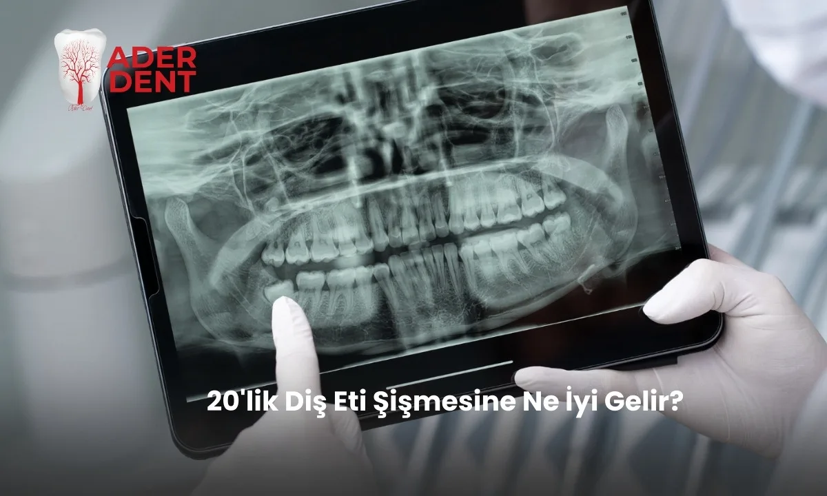 20'lik Diş Eti Şişmesine Ne İyi Gelir?