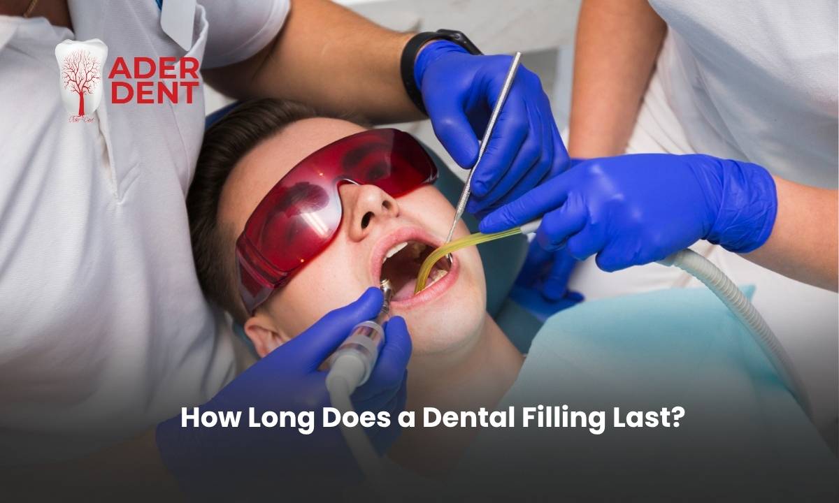 How Long Does a Dental Filling Last?