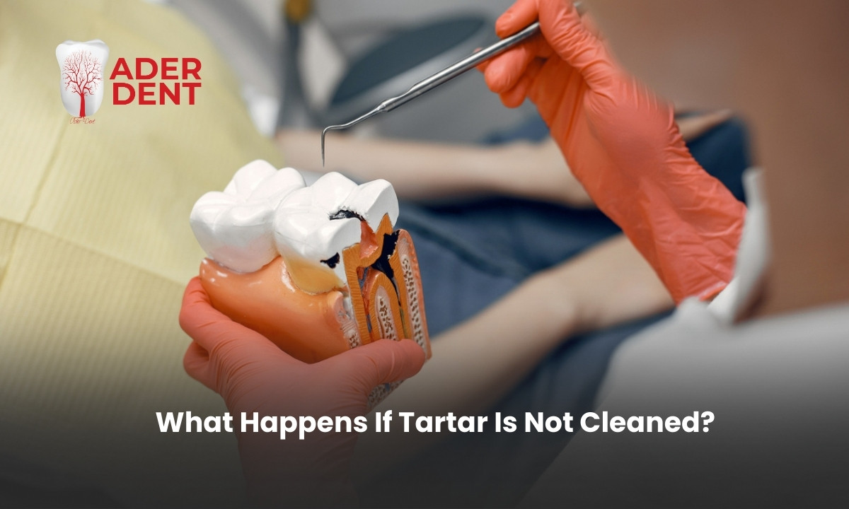 What Happens If Tartar Is Not Cleaned?