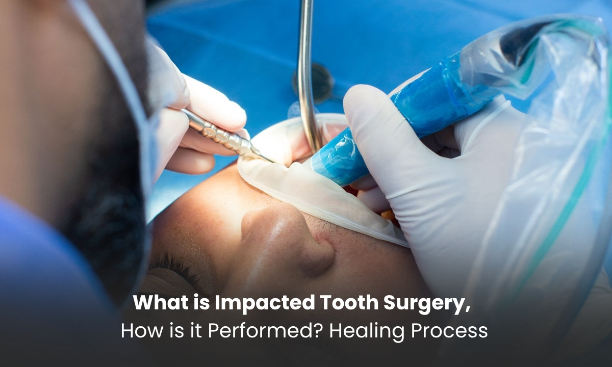 What is Impacted Tooth Surgery, How is it Performed? Healing Process