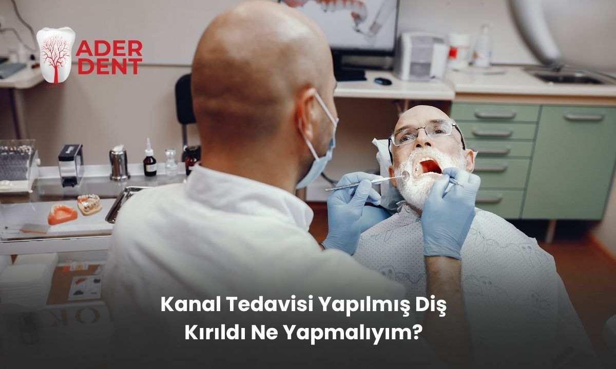 Kanal Tedavisi Yapılmış Diş Kırıldı, Ne Yapmalıyım?