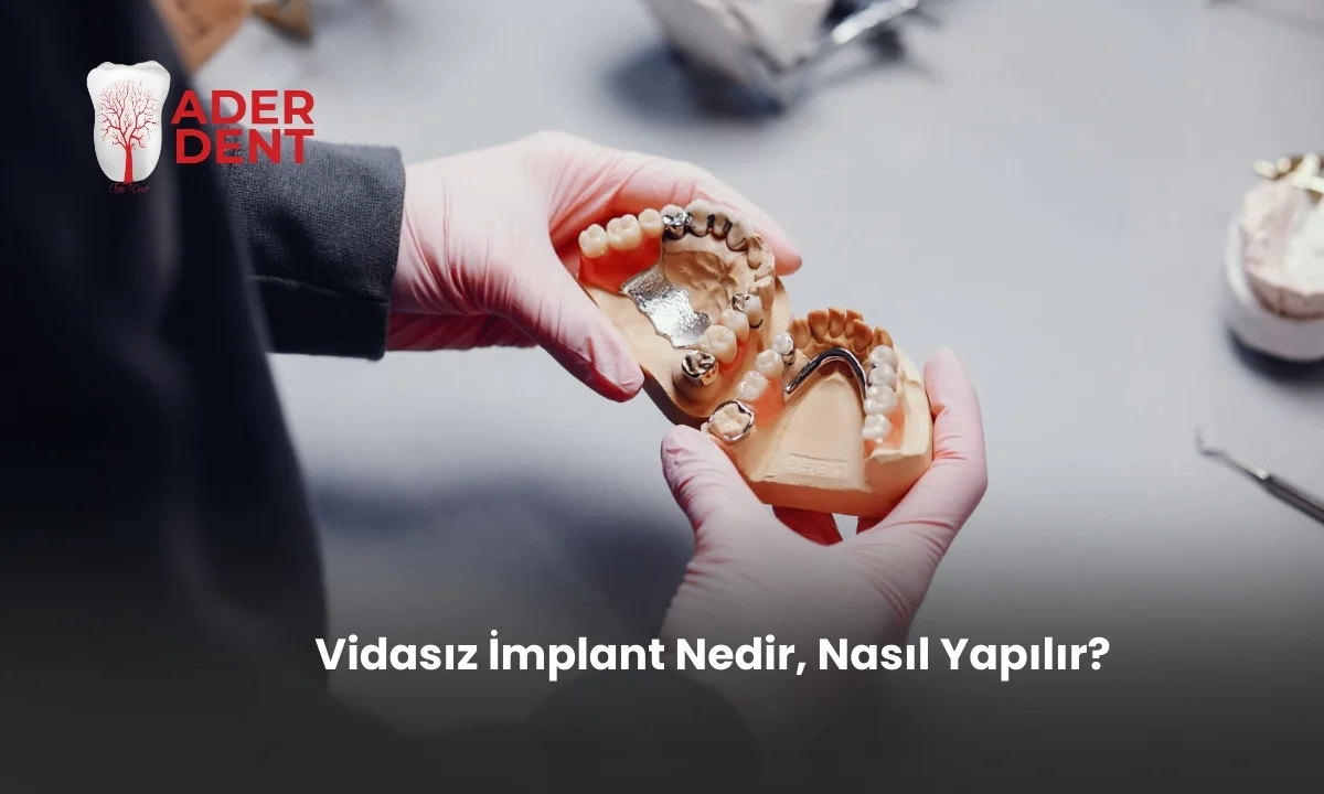 Vidasız İmplant Nedir, Nasıl Yapılır?