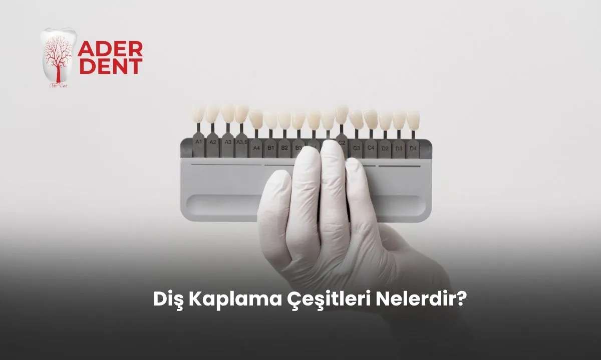 Diş Kaplama Çeşitleri Nelerdir?