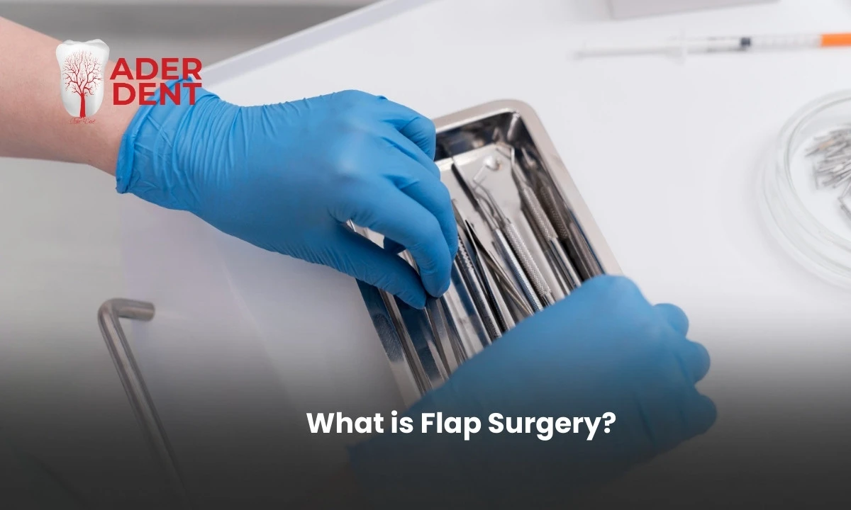  What is Flap Surgery?