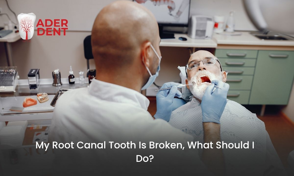 My Root Canal Tooth Is Broken, What Should I Do?