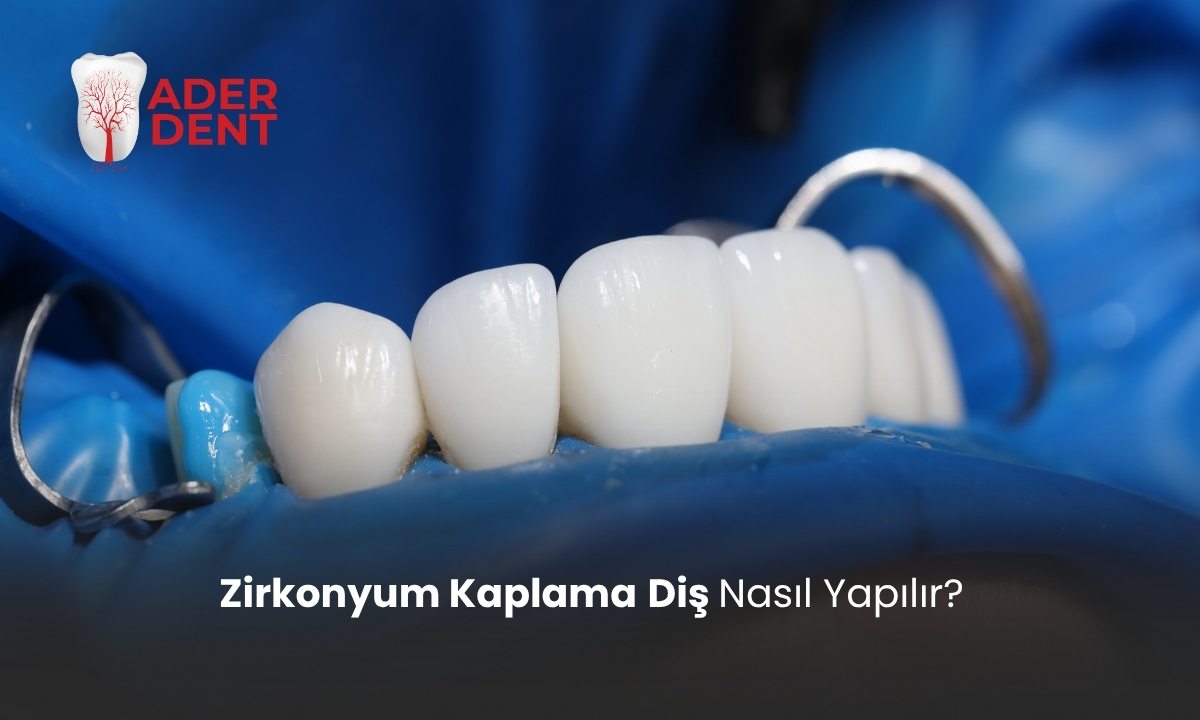 Zirkonyum Kaplama Diş Nasıl Yapılır?