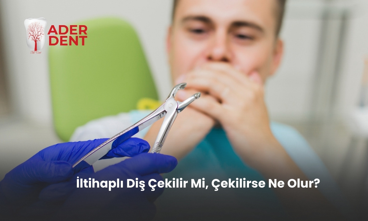 İltihaplı Diş Çekilir Mi, Çekilirse Ne Olur?