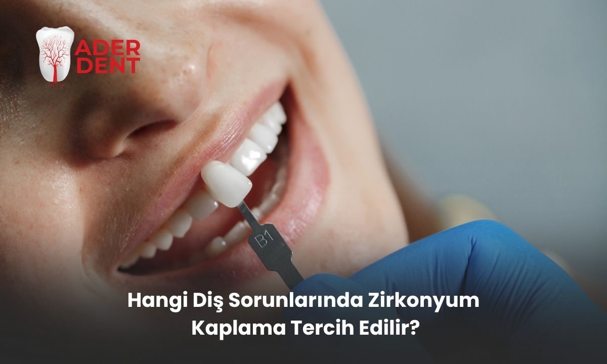 Hangi Diş Sorunlarında Zirkonyum Kaplama Tercih Edilir?