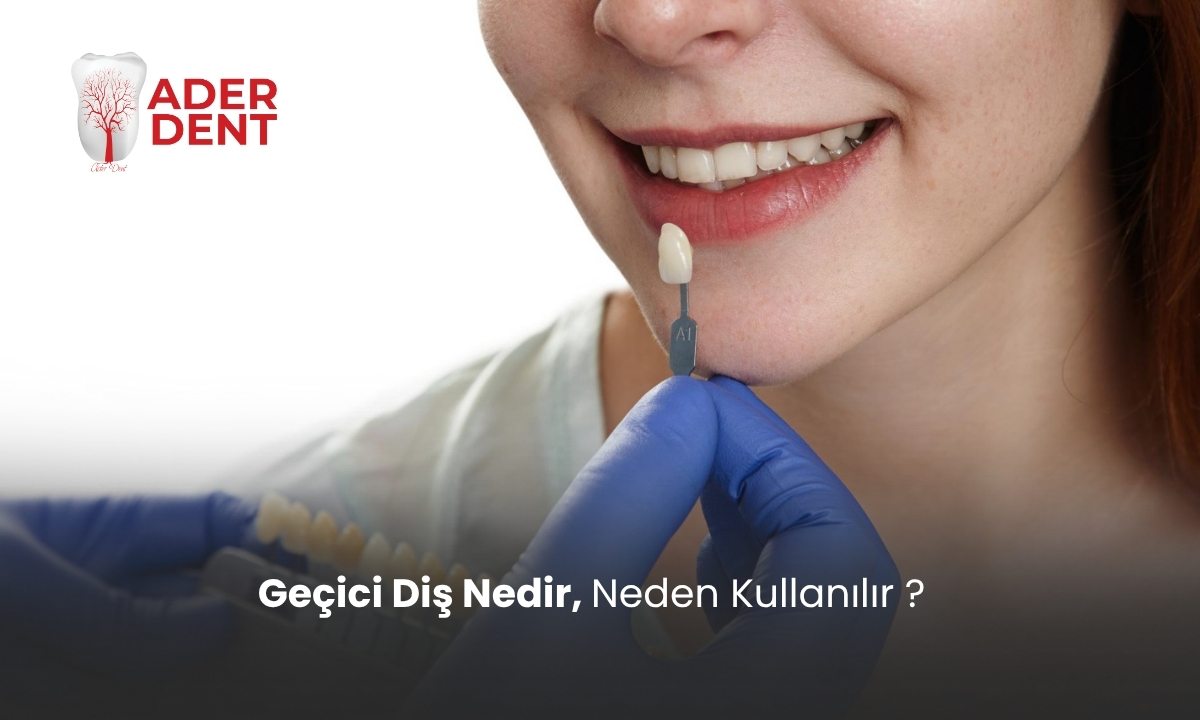Geçici Diş Nedir, Neden Kullanılır?