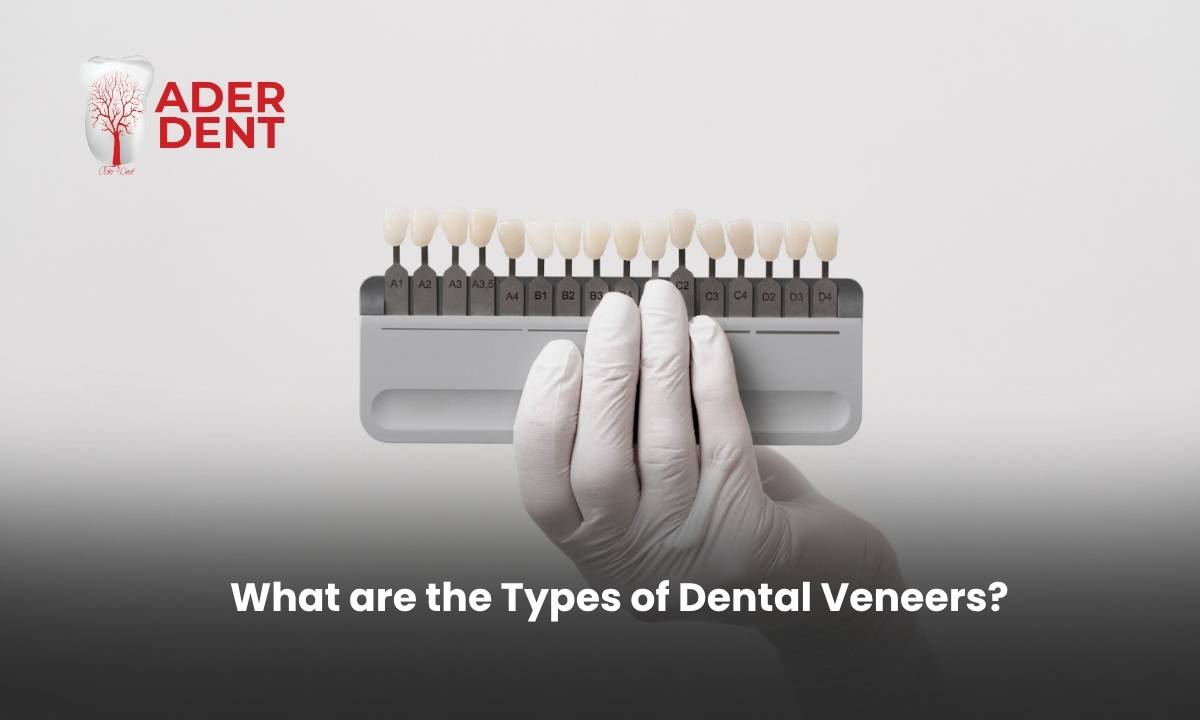 What are the Types of Dental Veneers?