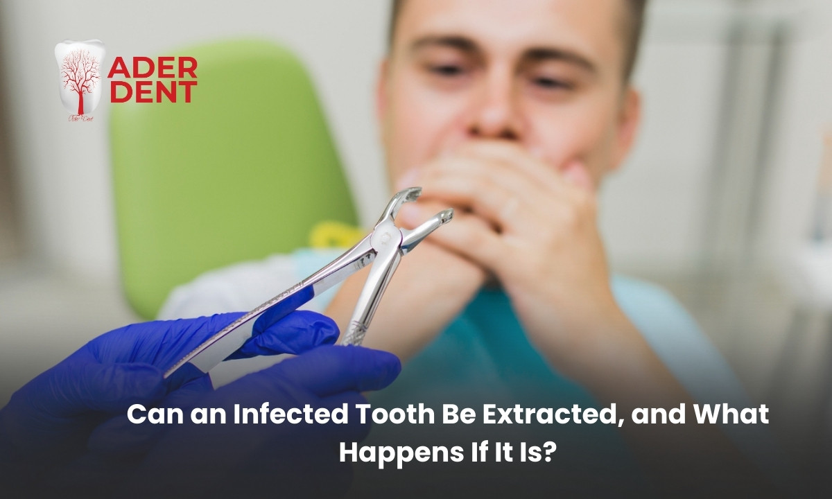 Can an Infected Tooth Be Extracted, and What Happens If It Is?