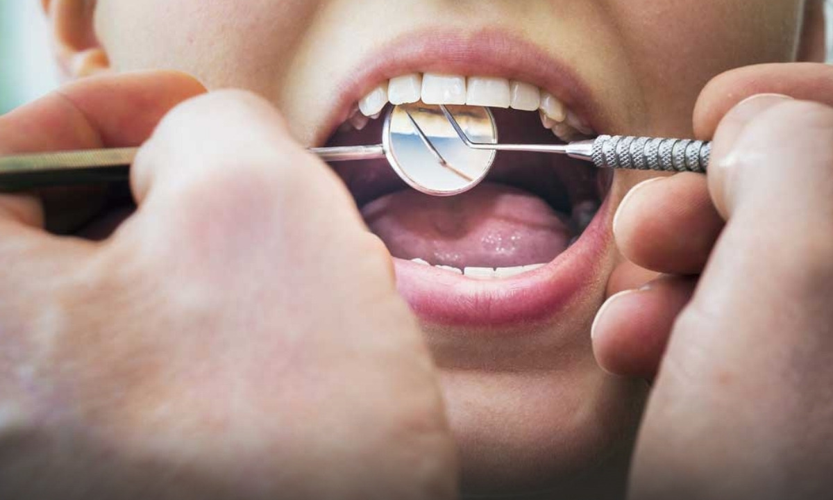 What Is Toothache?