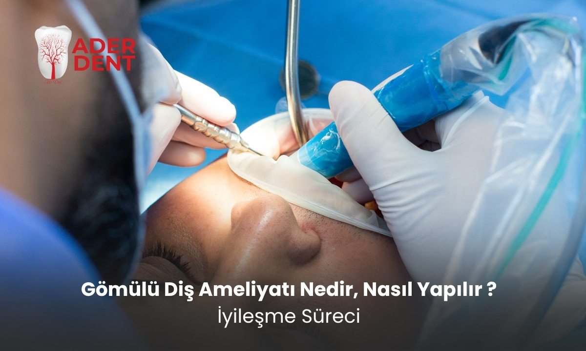Gömülü Diş Ameliyatı Nedir, Nasıl Yapılır? İyileşme Süreci