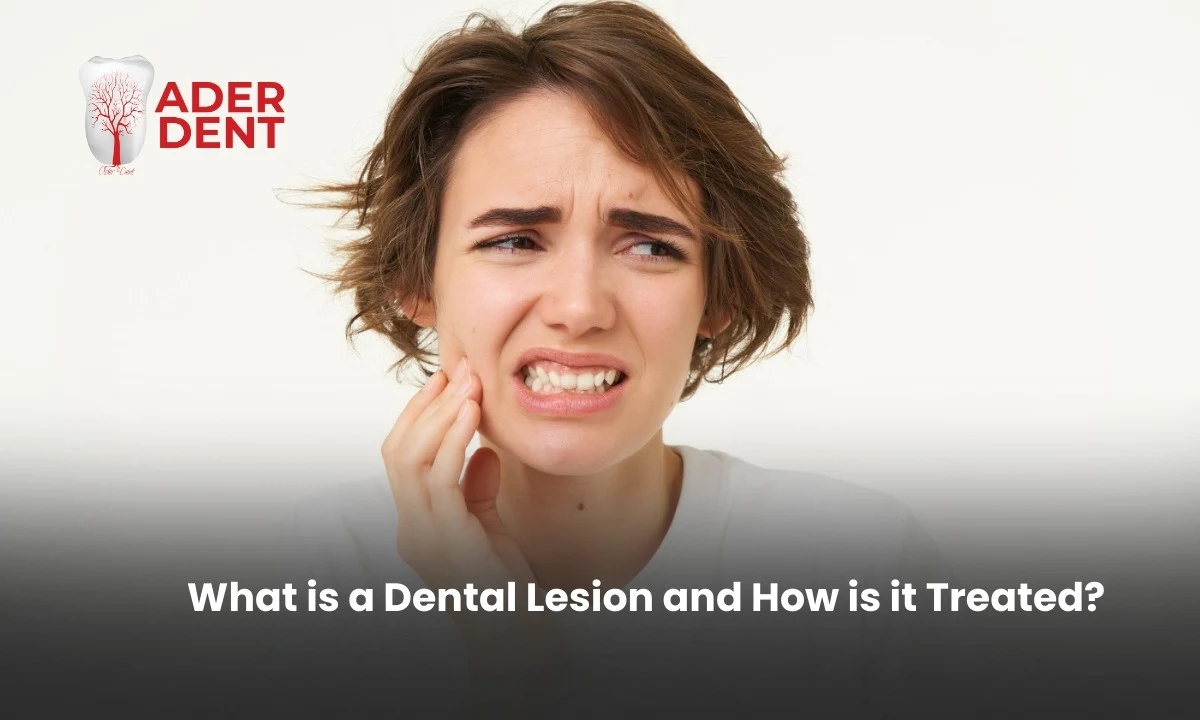 What is a Dental Lesion and How is it Treated?