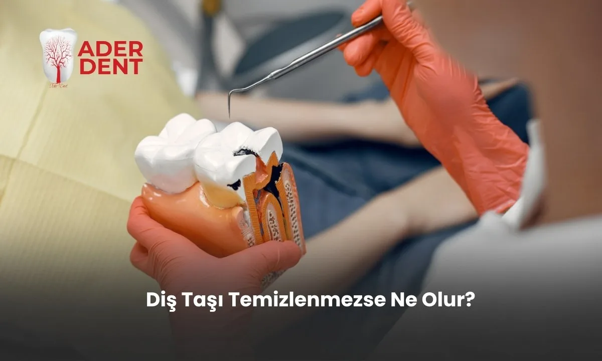 Diş Taşı Temizlenmezse Ne Olur?