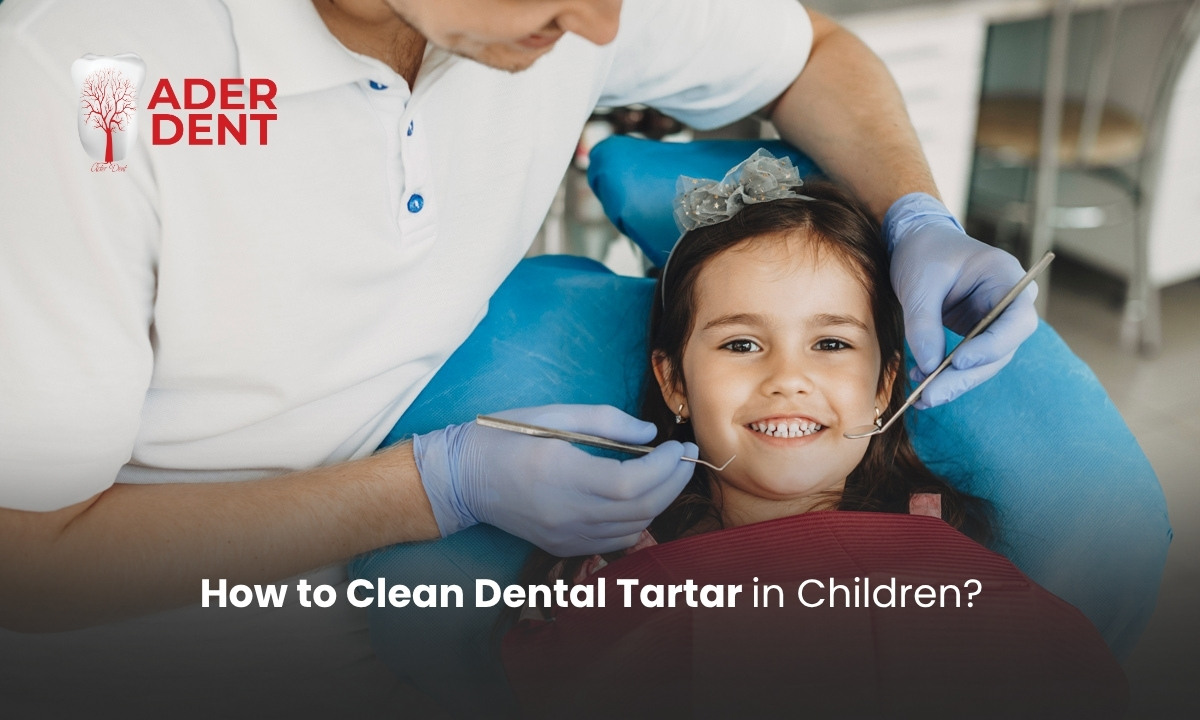 How to Clean Dental Tartar in Children?